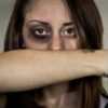 Woman covers her bruised face with her arm